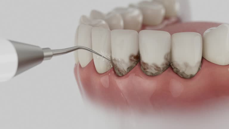 Reliable Emergency Dentist contractor in Seal Beach, CA by Smile Center Dentistry